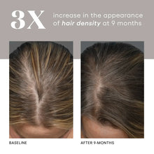 Load image into Gallery viewer, Plated Scalp Serum