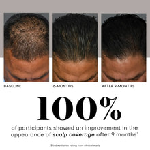 Load image into Gallery viewer, Plated Scalp Serum
