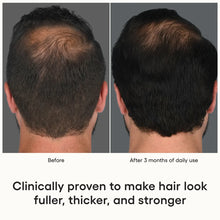 Load image into Gallery viewer, Plated Scalp Serum
